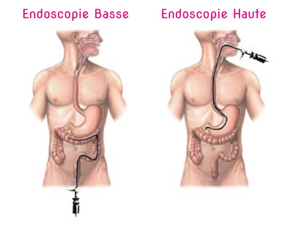 endoscopie-digestive-polyclinique-el-walid-ezzahra-tunisie